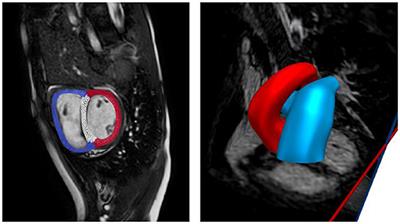 Multiscale Modeling Framework of Ventricular-Arterial Bi-directional Interactions in the Cardiopulmonary Circulation